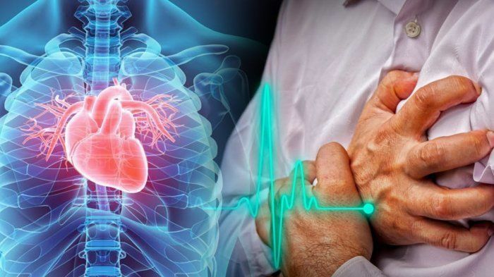 Dokter Ungkap Sederet Tanda Harus Berhenti Olahraga Biar Jantung Kamu Nggak Kolaps