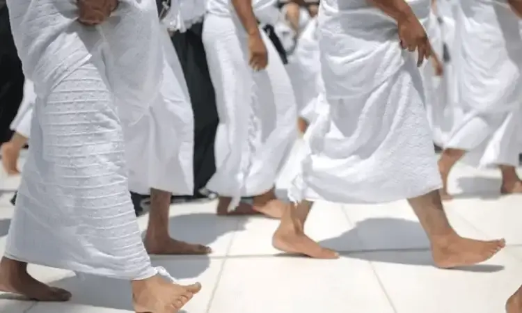 Melakukan Larangan dalam Ihram Tanpa Sengaja, Apakah Batal?